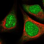 SRSF5 Antibody in Immunocytochemistry (ICC/IF)