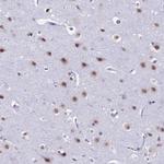 SRSF5 Antibody in Immunohistochemistry (Paraffin) (IHC (P))