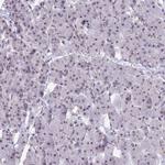 SRSF5 Antibody in Immunohistochemistry (Paraffin) (IHC (P))