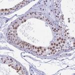 SRSF5 Antibody in Immunohistochemistry (Paraffin) (IHC (P))