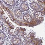 FERD3L Antibody in Immunohistochemistry (Paraffin) (IHC (P))