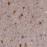 ELOA2 Antibody in Immunohistochemistry (Paraffin) (IHC (P))