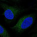 CYP51A1 Antibody in Immunocytochemistry (ICC/IF)