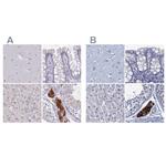 CYP51A1 Antibody in Immunohistochemistry (IHC)