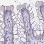 CYP51A1 Antibody in Immunohistochemistry (IHC)