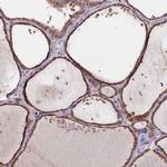 DCUN1D3 Antibody in Immunohistochemistry (Paraffin) (IHC (P))