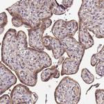 LGI4 Antibody in Immunohistochemistry (Paraffin) (IHC (P))