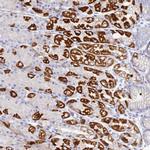 DHX34 Antibody in Immunohistochemistry (Paraffin) (IHC (P))