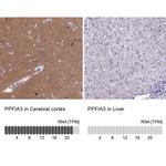 PPFIA3 Antibody in Immunohistochemistry (IHC)