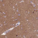 PPFIA3 Antibody in Immunohistochemistry (IHC)