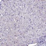 PPFIA3 Antibody in Immunohistochemistry (IHC)