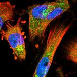 COPE Antibody in Immunocytochemistry (ICC/IF)