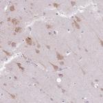 COPE Antibody in Immunohistochemistry (Paraffin) (IHC (P))