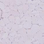 COPE Antibody in Immunohistochemistry (Paraffin) (IHC (P))