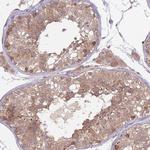 COPE Antibody in Immunohistochemistry (Paraffin) (IHC (P))