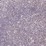 RBM12 Antibody in Immunohistochemistry (IHC)