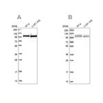 RBM12 Antibody in Western Blot (WB)