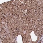 RBM42 Antibody in Immunohistochemistry (Paraffin) (IHC (P))