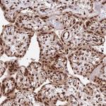 RBM42 Antibody in Immunohistochemistry (Paraffin) (IHC (P))