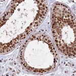 RBM42 Antibody in Immunohistochemistry (Paraffin) (IHC (P))