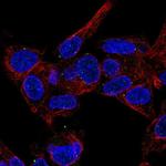 MVB12B Antibody in Immunocytochemistry (ICC/IF)