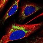 ACOT1 Antibody in Immunocytochemistry (ICC/IF)