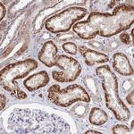 ACOT1 Antibody in Immunohistochemistry (IHC)