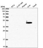 ACOT1 Antibody in Western Blot (WB)