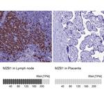 MZB1 Antibody in Immunohistochemistry (IHC)