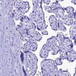 MZB1 Antibody in Immunohistochemistry (IHC)