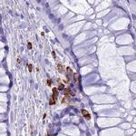 MZB1 Antibody in Immunohistochemistry (IHC)