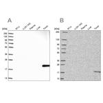 MZB1 Antibody in Western Blot (WB)