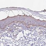 CAMSAP3 Antibody in Immunohistochemistry (IHC)