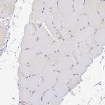 CAMSAP3 Antibody in Immunohistochemistry (IHC)