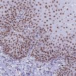 FAM170B Antibody in Immunohistochemistry (Paraffin) (IHC (P))