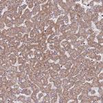 ACAD8 Antibody in Immunohistochemistry (Paraffin) (IHC (P))