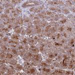 ACAD8 Antibody in Immunohistochemistry (IHC)