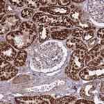 ACAD8 Antibody in Immunohistochemistry (IHC)