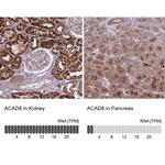 ACAD8 Antibody