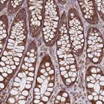 ACAD8 Antibody in Immunohistochemistry (IHC)