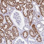 Pyruvate Carboxylase Antibody in Immunohistochemistry (Paraffin) (IHC (P))