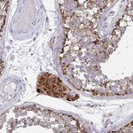 Pyruvate Carboxylase Antibody in Immunohistochemistry (Paraffin) (IHC (P))