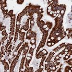 NDUFB6 Antibody in Immunohistochemistry (Paraffin) (IHC (P))