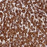 NDUFB6 Antibody in Immunohistochemistry (Paraffin) (IHC (P))