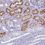 SLC36A2 Antibody in Immunohistochemistry (Paraffin) (IHC (P))