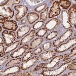 COX11 Antibody in Immunohistochemistry (Paraffin) (IHC (P))