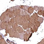 COX11 Antibody in Immunohistochemistry (Paraffin) (IHC (P))