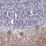 SLC1A6 Antibody in Immunohistochemistry (Paraffin) (IHC (P))