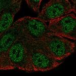 SRGAP3 Antibody in Immunocytochemistry (ICC/IF)