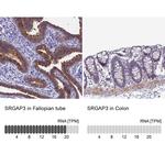 SRGAP3 Antibody in Immunohistochemistry (IHC)